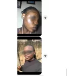 Customer review of dark spots cleared after using dang products