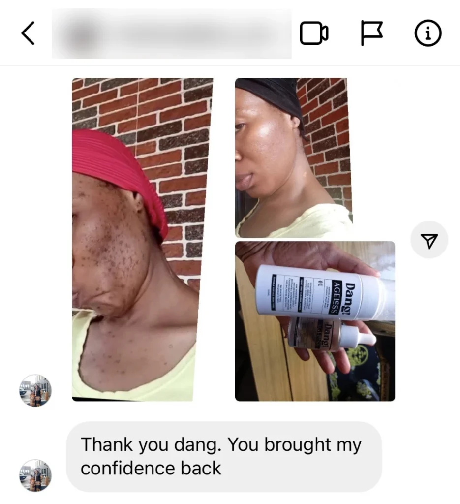 image of a woman whose Dang! products cleared her dark spots