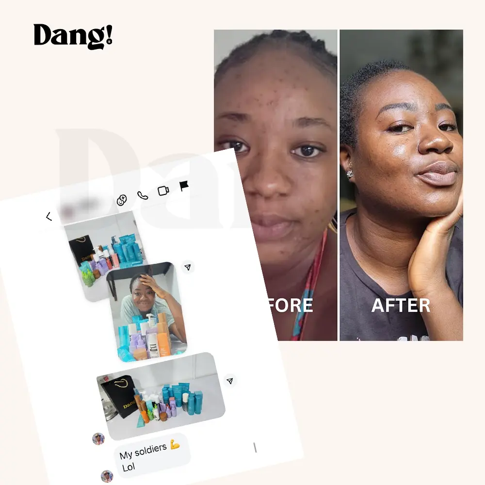 A collage featuring a "Before" and "After" photo of a person with improved skin, alongside images of danglifestlye skincare products available to buy online