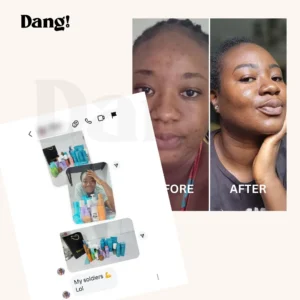 A woman with glowing skin after using Dang products