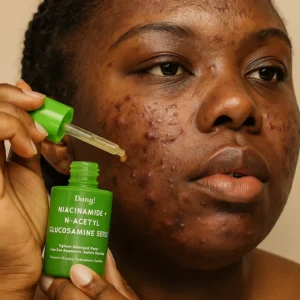 An image of a melanin-rich skin woman doing her skincare routine applying niacinamide serum-an effective ingredient for acne prone skin